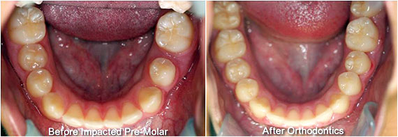 Smile Gallery at Bay Dental Family Dentistry and Orthodontics in Santa Ana, CA