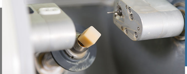 CEREC Dental Crowns Specialist Near Me in Santa Ana, CA CEREC Dental Crowns Specialist Near Me in Santa Ana, CA