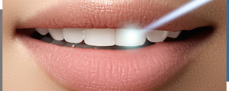 Laser Periodontal Therapy Near Me in Santa Ana, CA