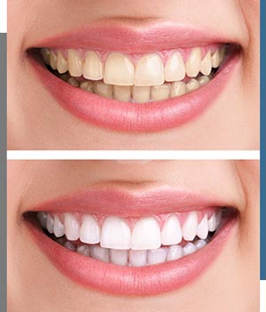 Smile Gallery - Bay Dental Family Dentistry and Orthodontics in Santa Ana, CA