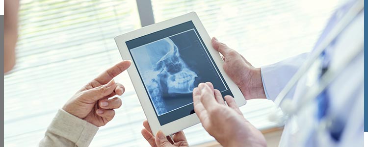 Digital Dental X-rays Near Me in Santa Ana, CA