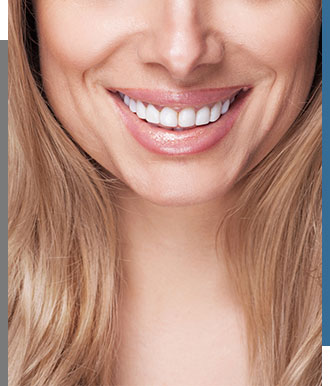 Veneers - Bay Dental Family Dentistry and Orthodontics in Santa Ana, CA