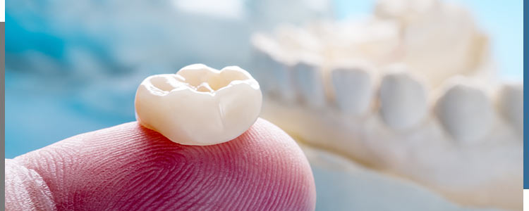 Dental Crowns Specialist Near Me in Santa Ana, CA Dental Crowns Specialist Near Me in Santa Ana, CA