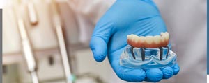 Dental Implants Questions Asked By Patients in Santa Ana, CA