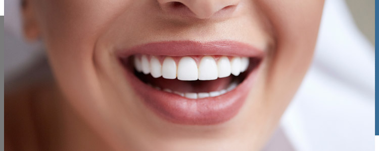Porcelain Veneers Near Me in Santa Ana, CA Porcelain Veneers Near Me in Santa Ana, CA