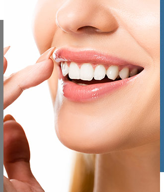 Charisma Chairside Whitening - Bay Dental Family Dentistry and Orthodontics in Santa Ana, CA