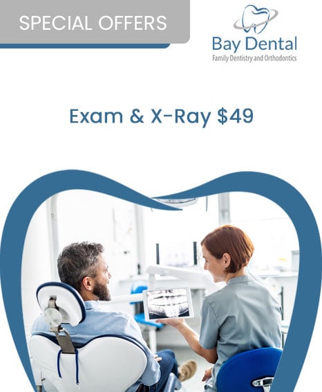 An advertisement for Bay Dental Family Dentistry & Orthodontics, promoting a special offer of $49 for an Exam & X-Ray. 
