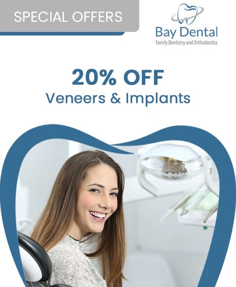 An advertisement for Bay Dental Family Dentistry & Orthodontics, promoting a 20% off Veneers & Implants special offer.