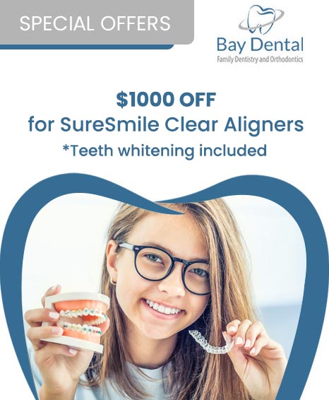 A promotional advertisement for Bay Dental Family Dentistry & Orthodontics, offering a $1,000 discount on SureSmile Clear Aligners with teeth whitening included. 