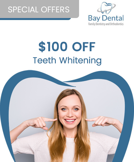 An advertisement for Bay Dental Family Dentistry & Orthodontics, promoting a special offer of $100 off Teeth Whitening.