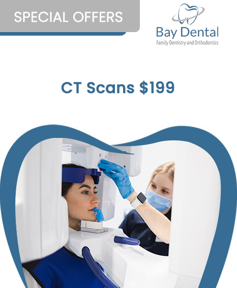 An advertisement for Bay Dental Family Dentistry & Orthodontics, promoting a special offer for CT scans priced at $199.